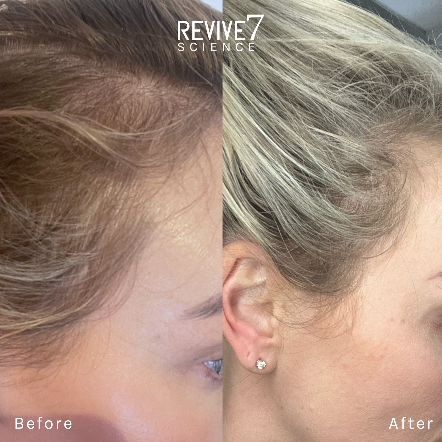 Revive7 Revitalizing Hair Treatment